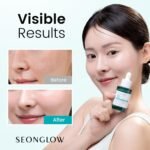 15% Vegan Niacinamide+ 3% Tranexamic Acid Serum: Korean Skin Care Niacinamide serum - Pore Minimizer for Face, Glutathione, Zinc PCA, 1.01 fl.oz.(30ml) - Image 2